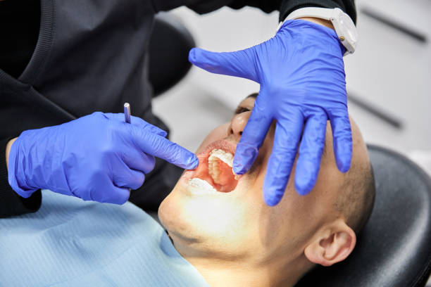 Best Emergency Wisdom Tooth Extraction in Cibolo, TX